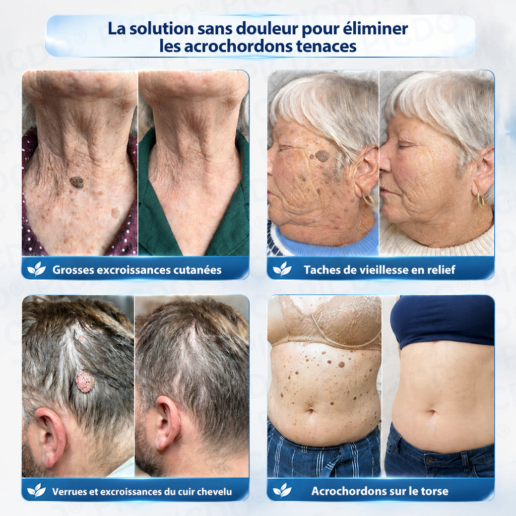 𝐏i𝐜𝐝o® – Félicitations ! Vous êtes notre grand gagnant 🎁 Vous bénéficiez de 50 % de réduction sur votre commande, soit la moitié du prix. Profitez de cette offre pour vous faire plaisir à moindre coût. Offre limitée dans le temps ✨